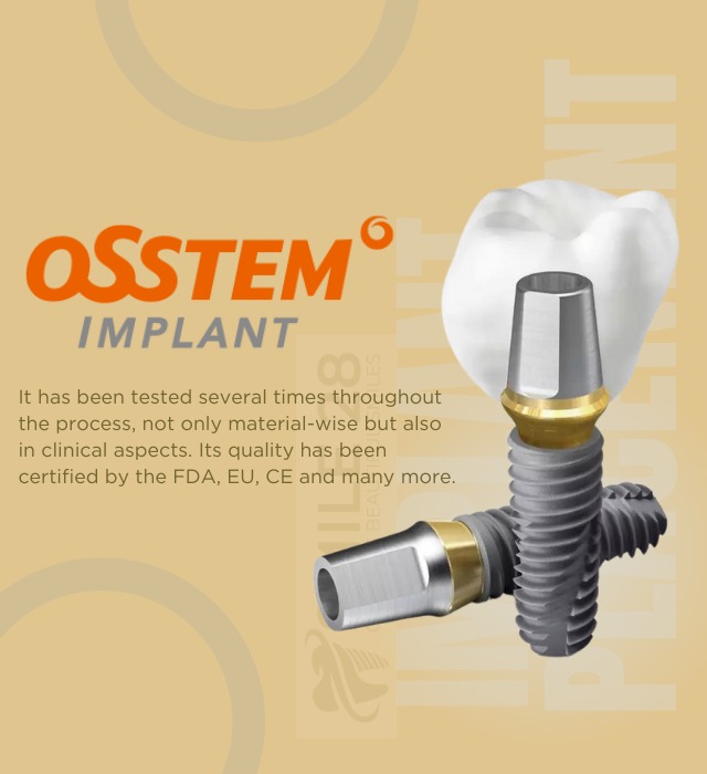 Implant Teeth Brand 3