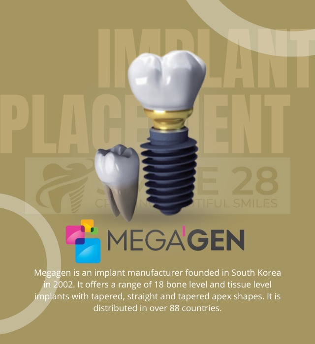 Implant Teeth Brand 4
